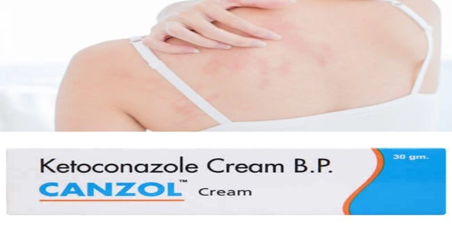 A girl showing effects of canzol cream