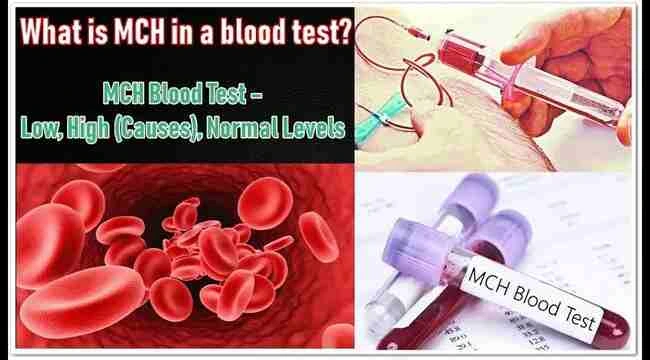 Mchc blood test