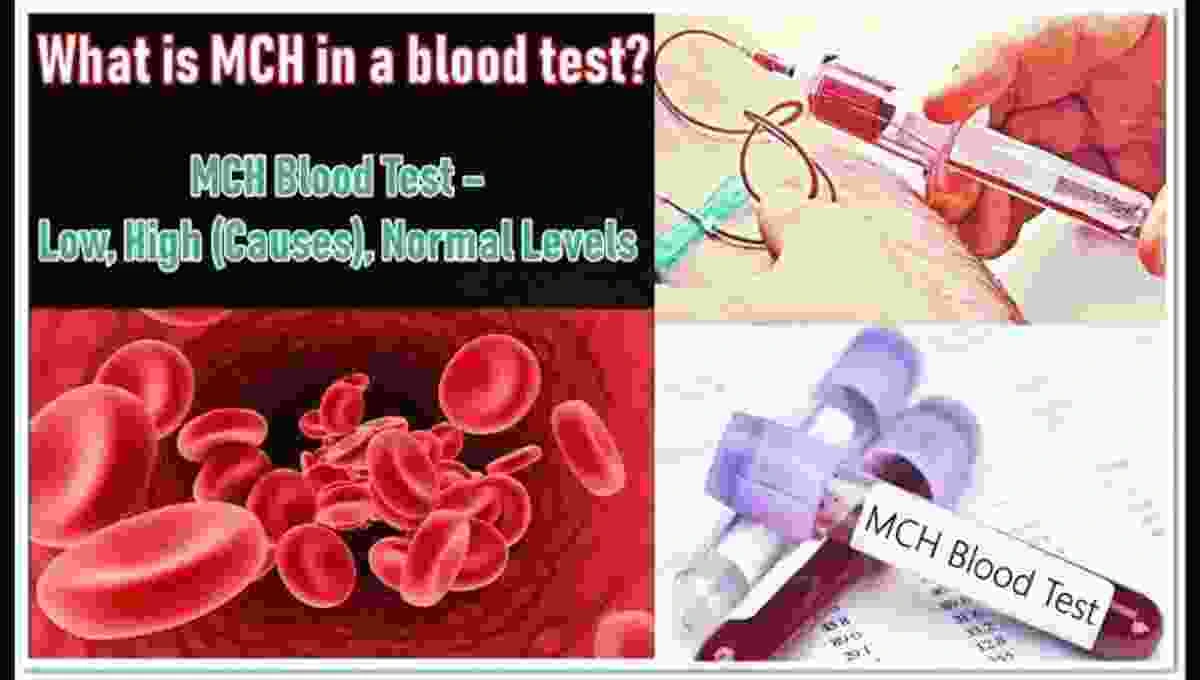 Mchc blood test how to do