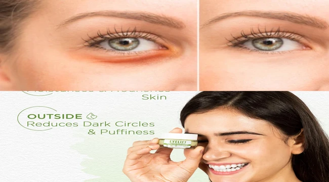A beautiful woman showing her eyes puffiness cure to Bella Vita eye lift cream