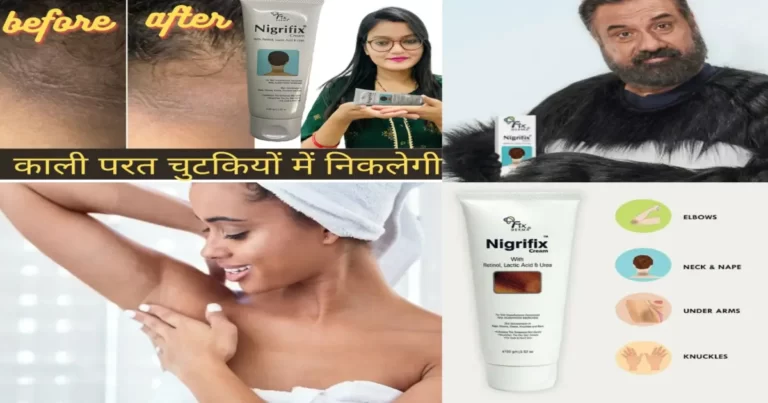 Fixderma Nigrifix Cream In Hindi