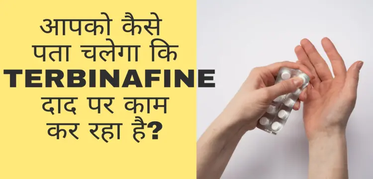 terbinafine tablet in hindi