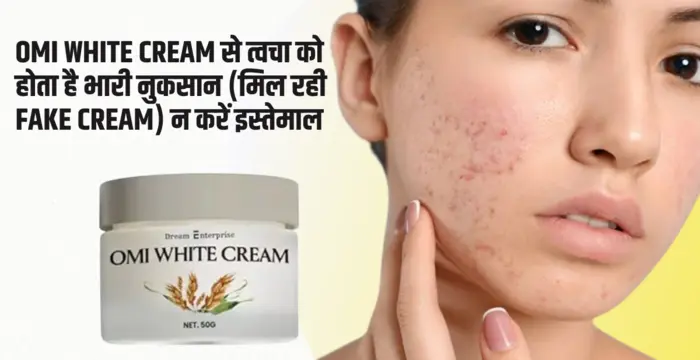 women showing side effect of Omi white cream