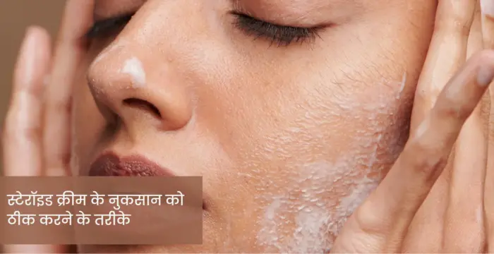women applying steroid cream on her face