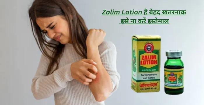 Zalim Lotion है बेहद खतरनाक इसे ना करें इस्तेमाल