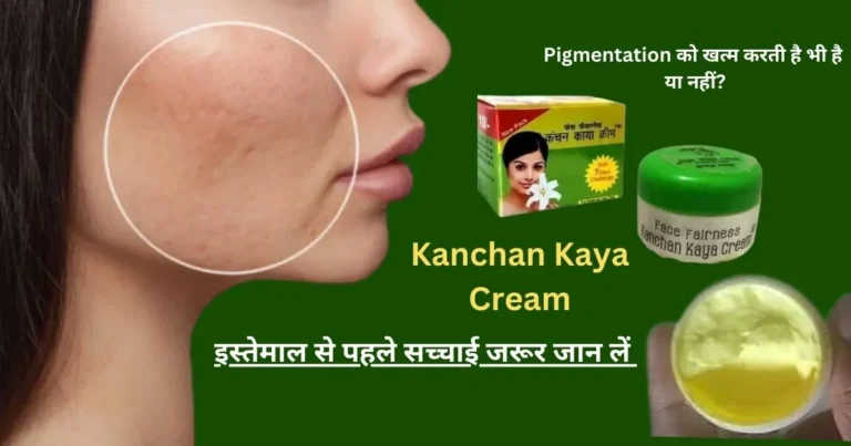 चेहरे की झाइयों को 100% कम करती है?Kanchan kaya cream सिर्फ 7 दिन लगाकर देखें! सच्चाई
